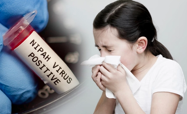 ไวรัสนิปาห์ อันตราย! เด็กติดเชื้ออาการแรงกว่าผู้ใหญ่ เสี่ยงพัฒนาการล่าช้า 