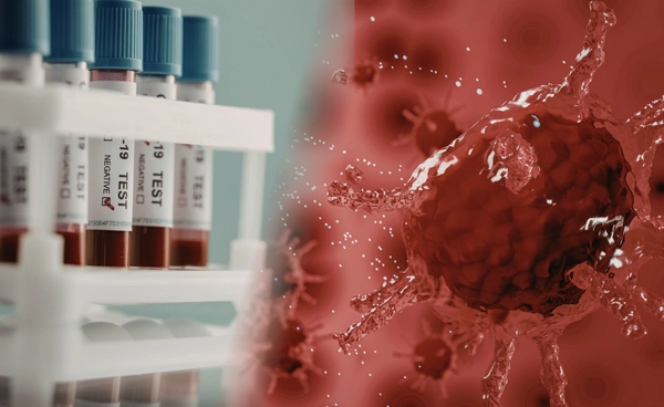 พัฒนาวิธี ตรวจเลือด คาดการณ์ความเสี่ยงมะเร็ง ศีรษะ-ลำคอ กลับมาเป็นซ้ำ