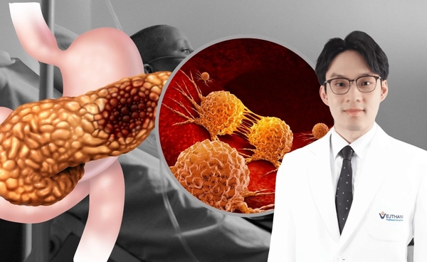 มะเร็งตับอ่อน ภัยเงียบที่คร่าชีวิตสูง เพราะรู้ตัวเมื่อสายเกินไป