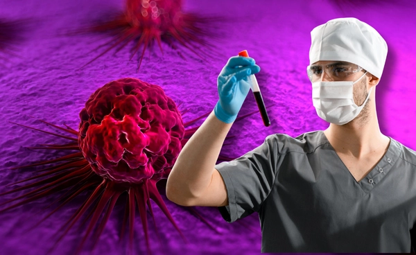 นักวิจัยออสซี่ใช้โปรตีน 4 ชนิดในเลือด พัฒนาชุดตรวจมะเร็งระยะเริ่มต้น