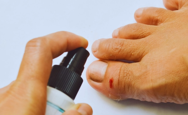 เกาหลีใต้พัฒนาผงห้ามเลือดไหลได้ใน 1 วินาที