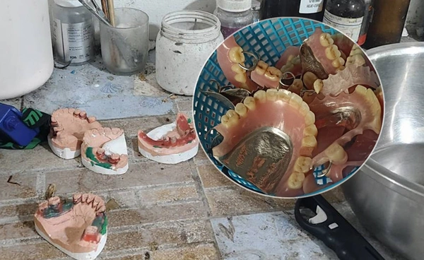 ตร.ไซเบอร์ บุกทลายฟันปลอมเถื่อนกลางเมืองขอนแก่น สภาพร้านชวนขนลุก!