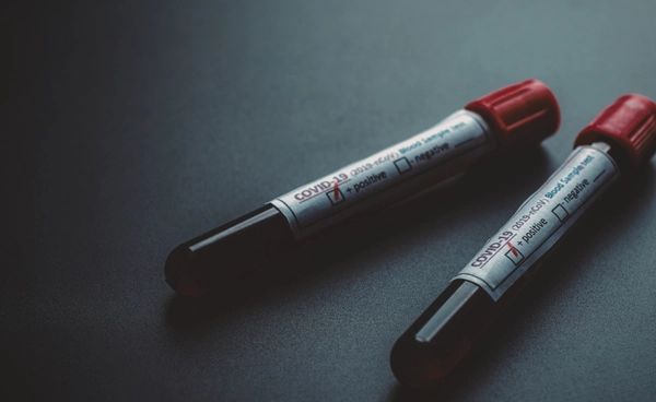 ผลเจาะเลือดบอกโรคทางสมองได้ นวัตกรรมใหม่ช่วยผู้ป่วยไม่ต้องผ่าตัด เข้าเครื่องสแกนแพง