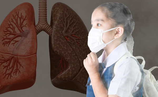 งานวิจัยชี้ เด็กประถมเชียงใหม่ 52% มีภาวะปอดผิดปกติ จากการดมฝุ่นพิษ