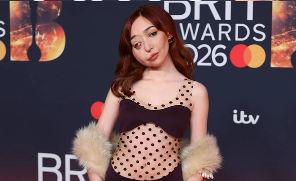 รู้จัก นิกกี้ ลิลลี่ สาวที่แม้ใบหน้าผิดรูป แต่ก็ไม่ใช่ต้องเก็บตัวจากสังคม