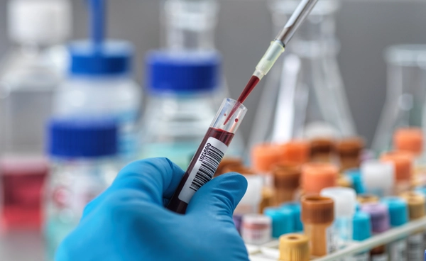 โลกร้อนกระทบสุขภาพ ดันคาร์บอนไดออกไซด์ในเลือดพุ่ง ร่างกายมนุษย์เสี่ยงอ่อนแอลง