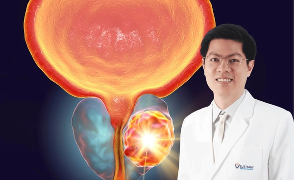 หุ่นยนต์ดาวินชี เทคโนโลยีการผ่าตัดมะเร็งต่อมลูกหมาก