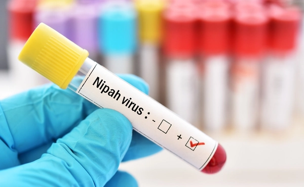 รู้จัก "ไวรัสนิปาห์" 1 ใน 13 โรคติดต่ออันตราย เช็กอาการ วิธีป้องกัน