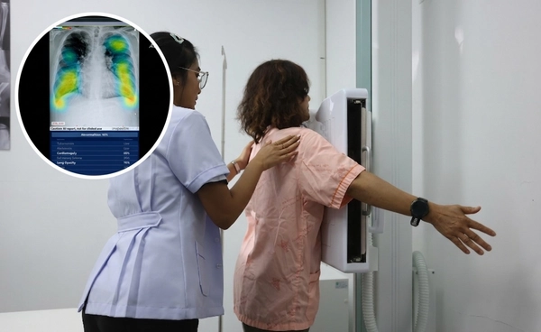 "ใช้ AI ช่วยวิเคราะห์ Chest X-ray" รพ.เกาะเต่า ยกระดับสาธารณสุขไทย คัดกรองโรคแม่นยำ ลดภาระแพทย์