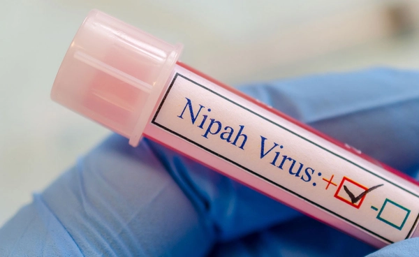 สธ. ตรวจสอบแล้วยังไม่พบผู้ป่วยไวรัสนิปาห์ในไทย 