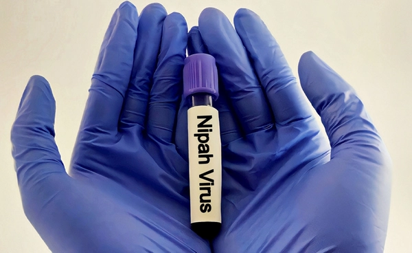 สนามบินทั่วเอเชีย ยกระดับคัดกรอง "ไวรัสนิปาห์" หวั่นแพร่ระบาด!