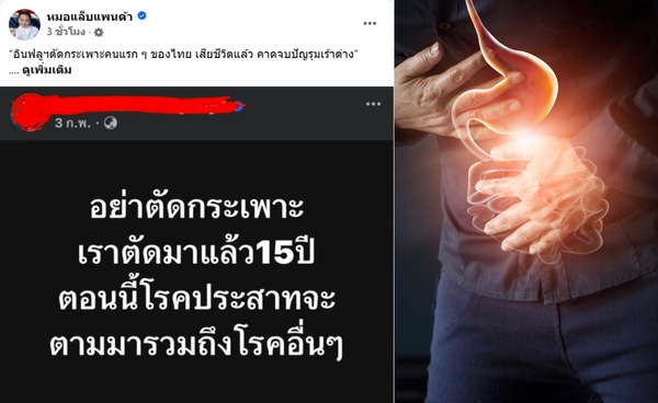 "ตัดกระเพาะ" มีผลเสียระยะยาว? อุทาหรณ์อินฟลูฯดังเสียชีวิต หลังตัดมานานกว่า 15 ปี 