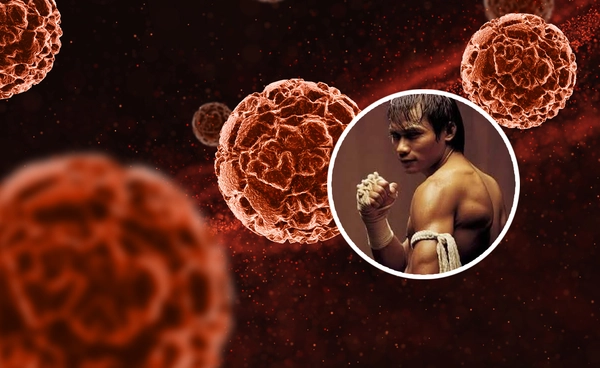 มะเร็งถุงน้ำดี โรคตรวจยาก หลัง “จา พนม” ป่วยระยะ 3 ใกล้ระยะ 4