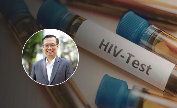 ทลายเกราะ "เซลล์ซ่อนไวรัส" ก้าวสำคัญสู่การรักษา HIV ให้หายขาด