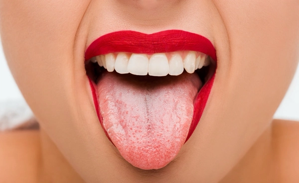 สีของลิ้นบอกโรค ลิ้นแบบไหนต้องระวัง ? 