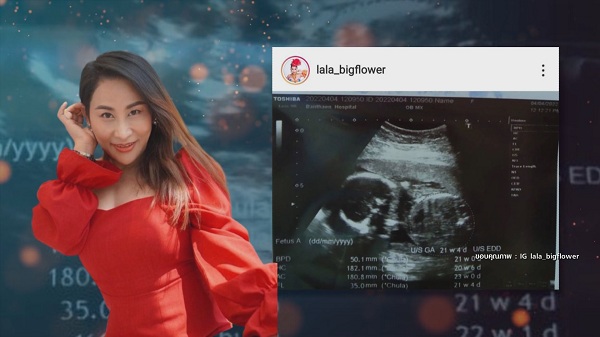 “ลาล่า อาร์สยาม” เคลียร์ชัด ภาพอัลตร้าซาวด์เป็นข่าวดีของน้อง (มีคลิป) 