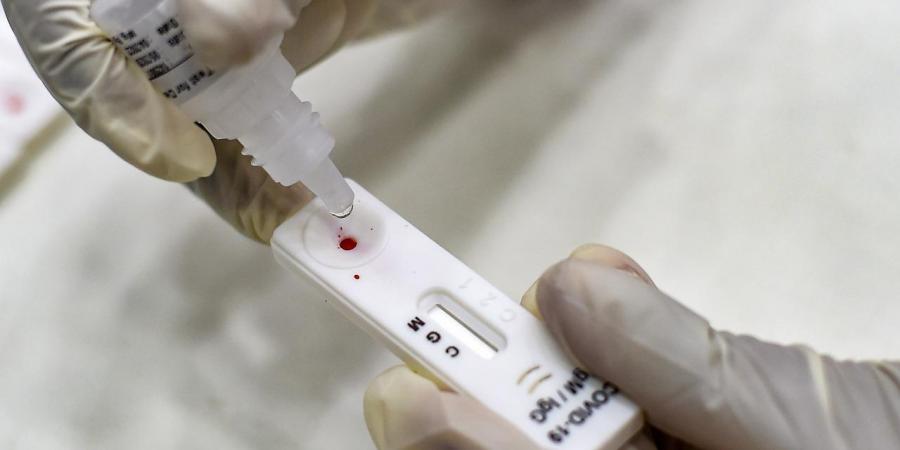 รู้จัก Rapid Antigen Test ชุดตรวจโควิดแบบเร่งด่วน รู้ผลเร็วภายใน 15 นาที