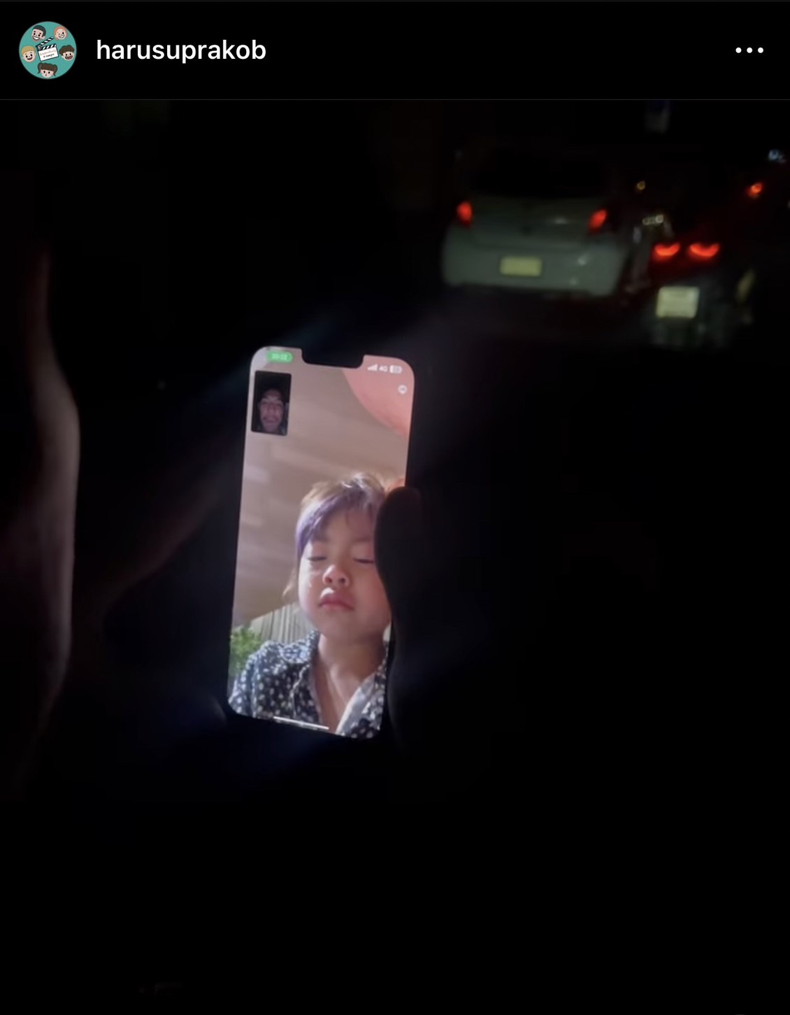 ร่วมส่งกำลังใจ กาย รัชชานนท์ ผ่าตัดกระดูกข้อมือและเส้นเอ็น ร่วมส่งกำลังใจ กาย รัชชานนท์ ผ่าตัดกระดูกข้อมือและเส้นเอ็น