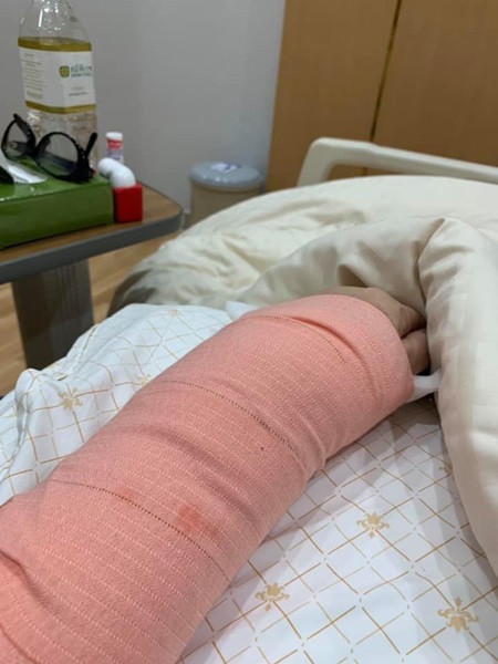 เหตุเพราะห่วง!! เบคกี้ ริสา หงษ์หิรัญ เกิดอุบัติเหตุ ลื่นล้มข้อมือหัก เหตุเพราะห่วง!! เบคกี้ ริสา หงษ์หิรัญ เกิดอุบัติเหตุ ลื่นล้มข้อมือหัก