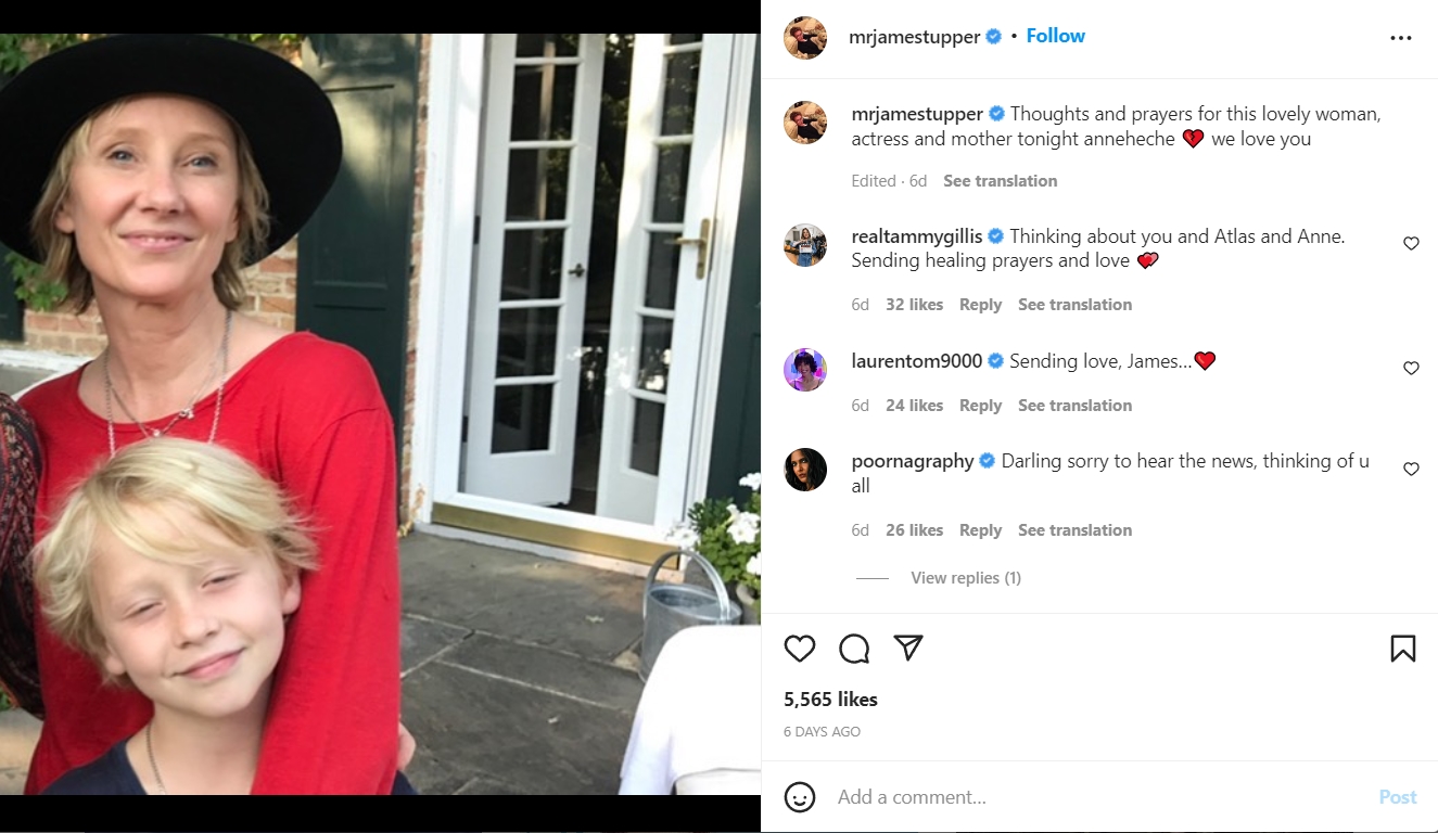    “Anne Heche” เสียชีวิตแล้วหลังบาดเจ็บหนักจากรถชน 