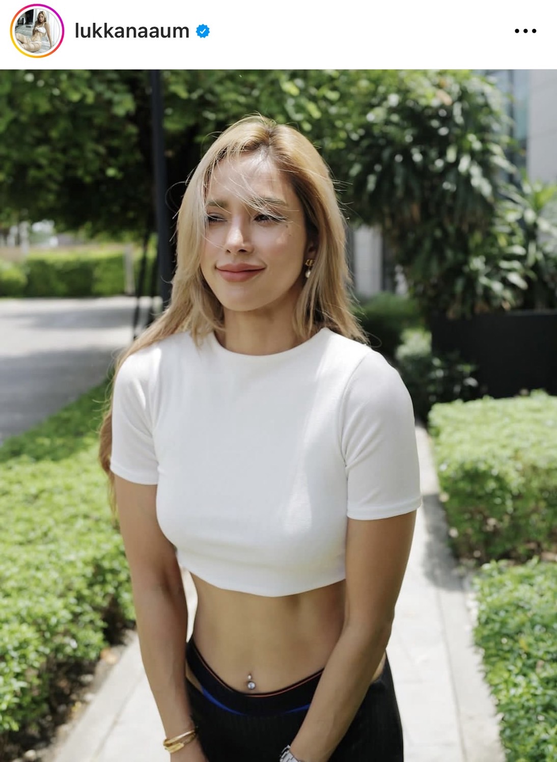 น้องดิสนีย์ ลูกสาว อุ้ม ลักขณา ได้รับบาดเจ็บ