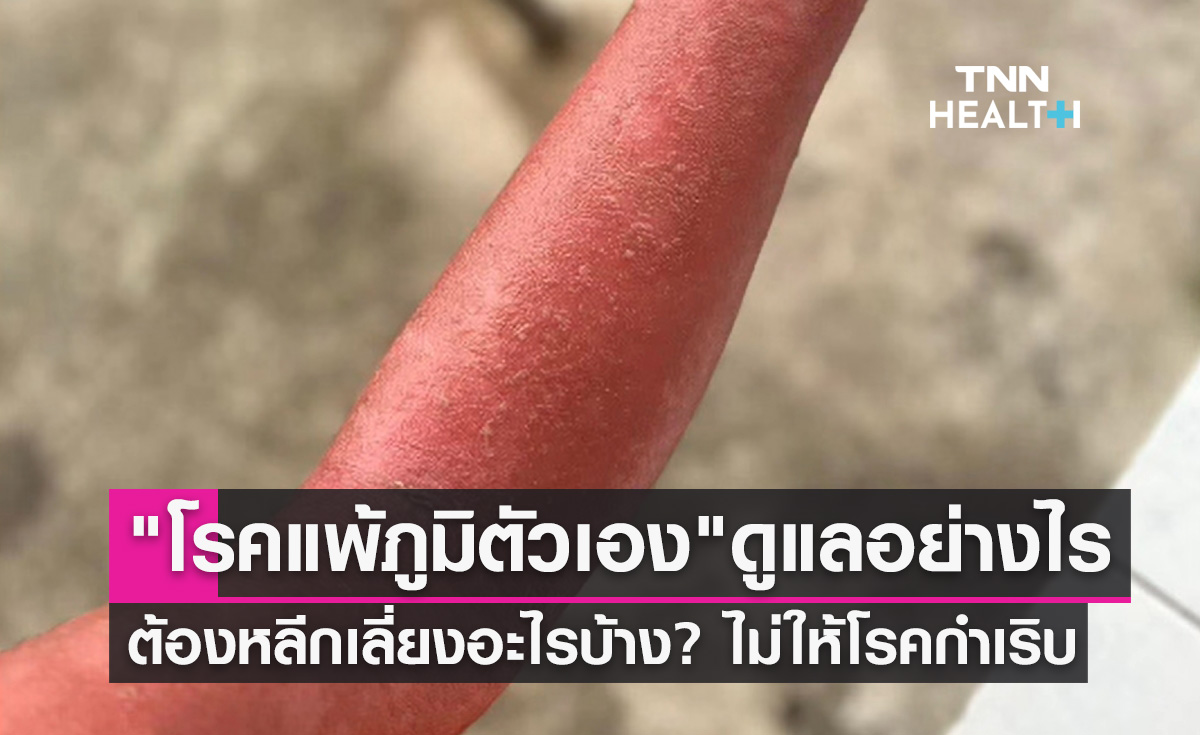 "โรคแพ้ภูมิตัวเอง" ดูแลตัวเองอย่างไร ต้องหลีกเลี่ยงอะไรบ้าง ไม่ให้โรคกำเริบ