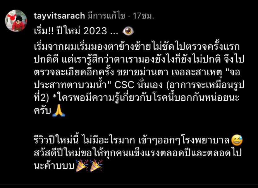 เต้ วิทย์สรัช ป่วยรับปีใหม่ เป็นโรค CSC จอประสาทตาบวม เต้ วิทย์สรัช ป่วยรับปีใหม่ เป็นโรค CSC จอประสาทตาบวม
