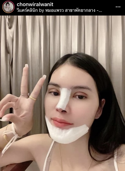 เอ๋ มิรา อัพความสวย ศัลยกรรมจมูก ตา และคาง เอ๋ มิรา อัพความสวย ศัลยกรรมจมูก ตา และคาง