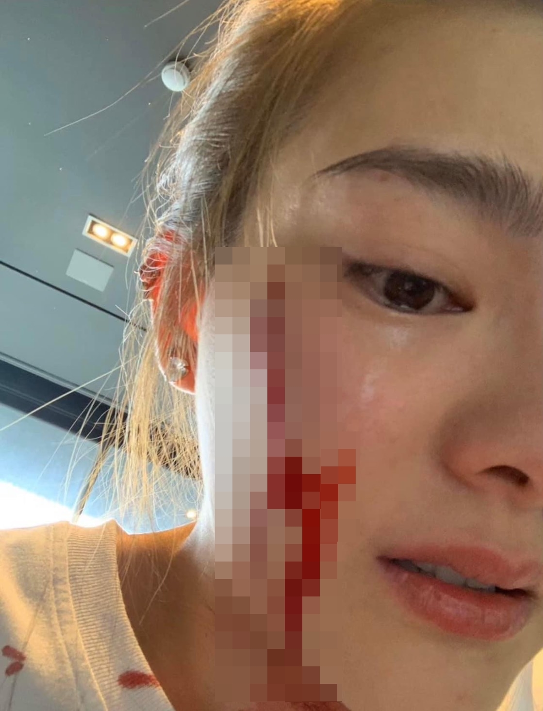 ไผ่ วันพ้อยท์ โพสต์ปกป้อง ดิว อริสรา พร้อมเผยภาพถูกทำร้ายร่างกาย