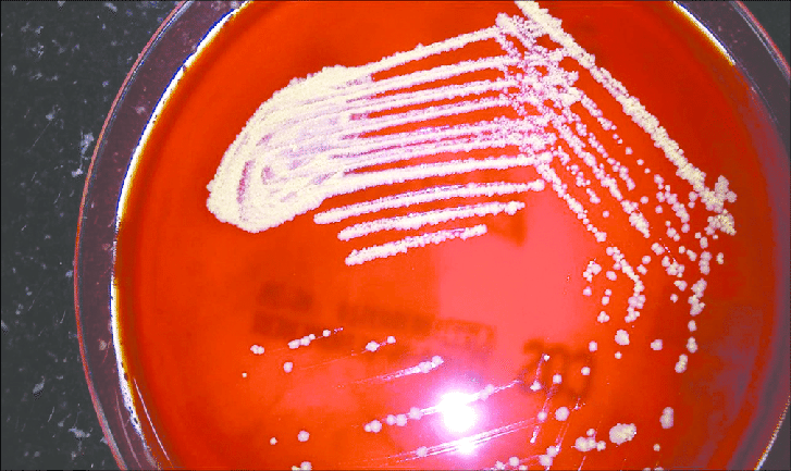 Phage ไวรัสกำจัดแบคทีเรีย ใช้รักษาโรคติดเชื้อดื้อยาปฏิชีวนะ Phage ไวรัสกำจัดแบคทีเรีย ใช้รักษาโรคติดเชื้อดื้อยาปฏิชีวนะ