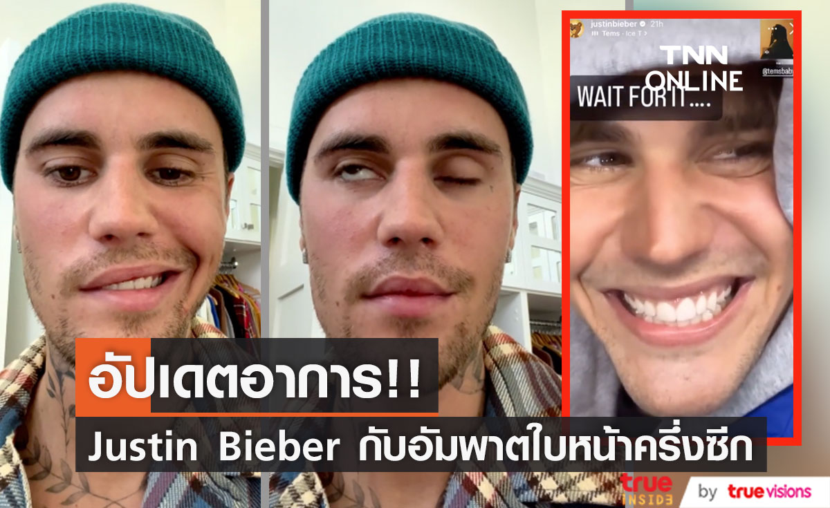 ดีขึ้นมาก!! 'จัสติน บีเบอร์' ยิ้มกว้างอัปเดตอาการอัมพาตใบหน้าครึ่งซีก