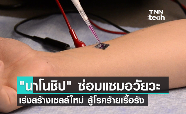 "นาโนชิป" เร่งสร้างเซลล์ใหม่ ซ่อมแซมอวัยวะที่เสียหายในเวลาอันรวดเร็ว