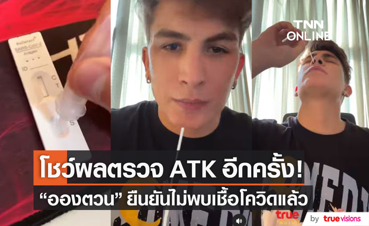 ตรวจ ATK โชว์!! "อองตวน ปินโต" ยืนยัน ไม่พบเชื้อโควิด-19 แล้ว
