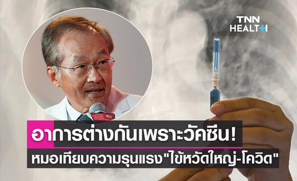 หมอมนูญ เทียบความรุนแรง "ไข้หวัดใหญ่-โควิด" ในผู้ป่วยคนเดียวกัน 
