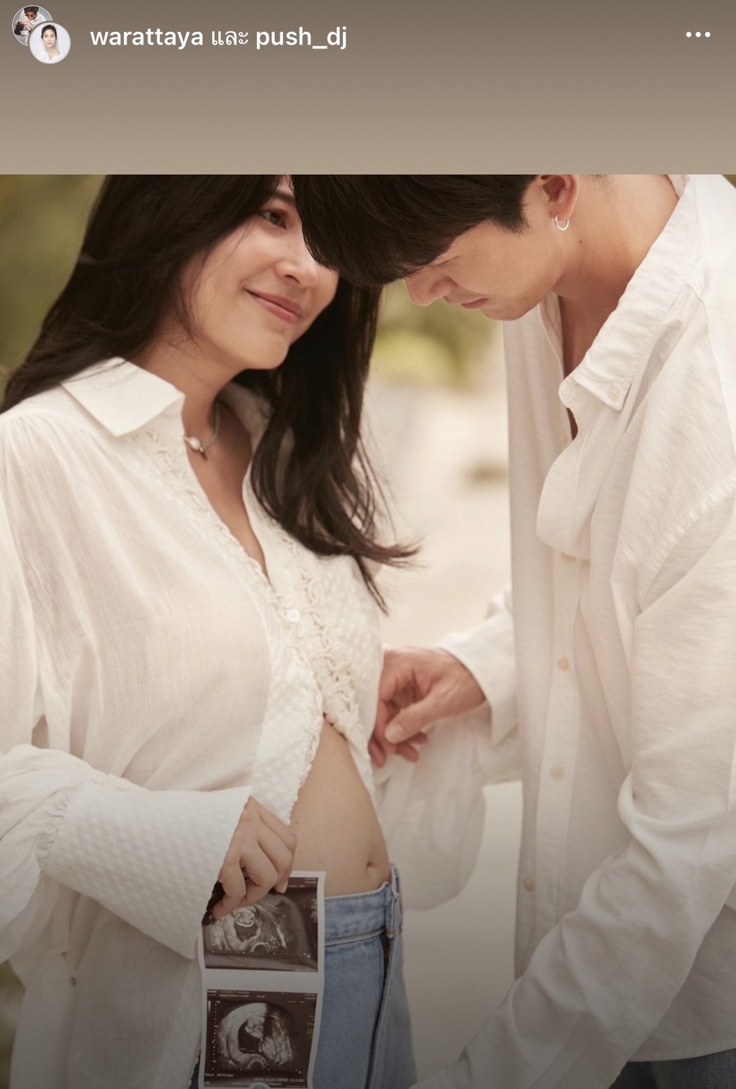 ดีเจพุฒ-จุ๋ย วรัทยา แจ้งข่าวดี ท้องลูกคนแรกแล้ว!! หลังพยายามกันอย่างหนัก ดีเจพุฒ-จุ๋ย วรัทยา แจ้งข่าวดี ท้องลูกคนแรกแล้ว!! หลังพยายามกันอย่างหนัก