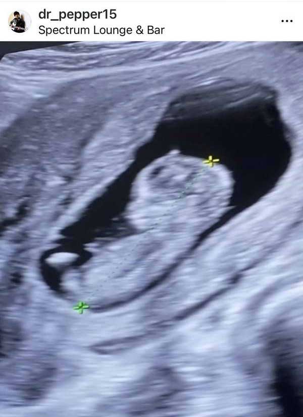 เปปเปอร์ UHT ฉลองครบรอบแต่งงาน4ปี แจ้งข่าวดี! ภรรยาตั้งท้องแล้ว เปปเปอร์ UHT ฉลองครบรอบแต่งงาน4ปี แจ้งข่าวดี! ภรรยาตั้งท้องแล้ว