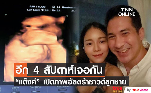 ดีใจหนักมาก "แต๊งค์ พงศกร" เปิดภาพอัลตร้าซาวด์ลูกชาย เผย อีก 4 สัปดาห์จะเจอกันเเล้ว