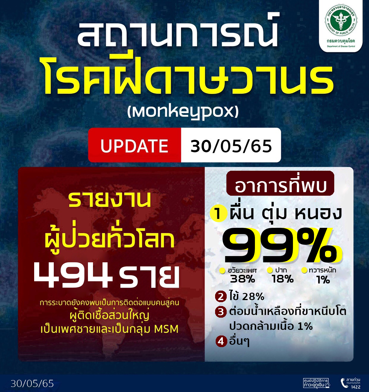 ยืนยันไทยยังไม่พบผู้ป่วยโรคฝีดาษลิง ติดตาม 12 รายใกล้ชิดผู้ป่วยระหว่าเดินทาง ยังปลอดภัย