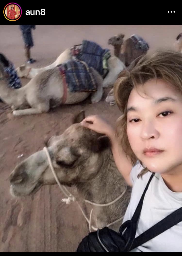 “อ้วน รีเทิร์น” เผยแผลที่มือดีขึ้นแล้ว หลังวิดหนีอูฐที่ประเทศโอมาน