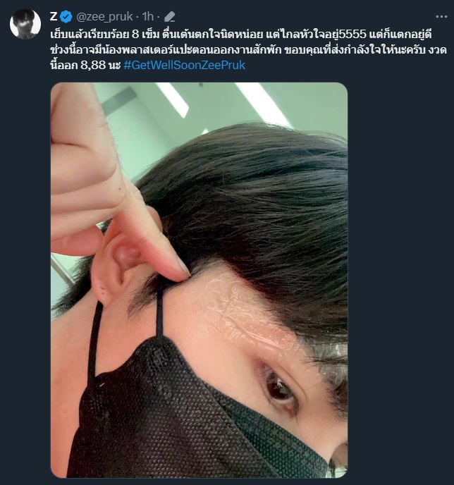 บาดเจ็บ เย็บ 8 เข็ม!! ซี พฤกษ์ ประสบอุบัติเหตุขณะถ่ายทำซีรีส์