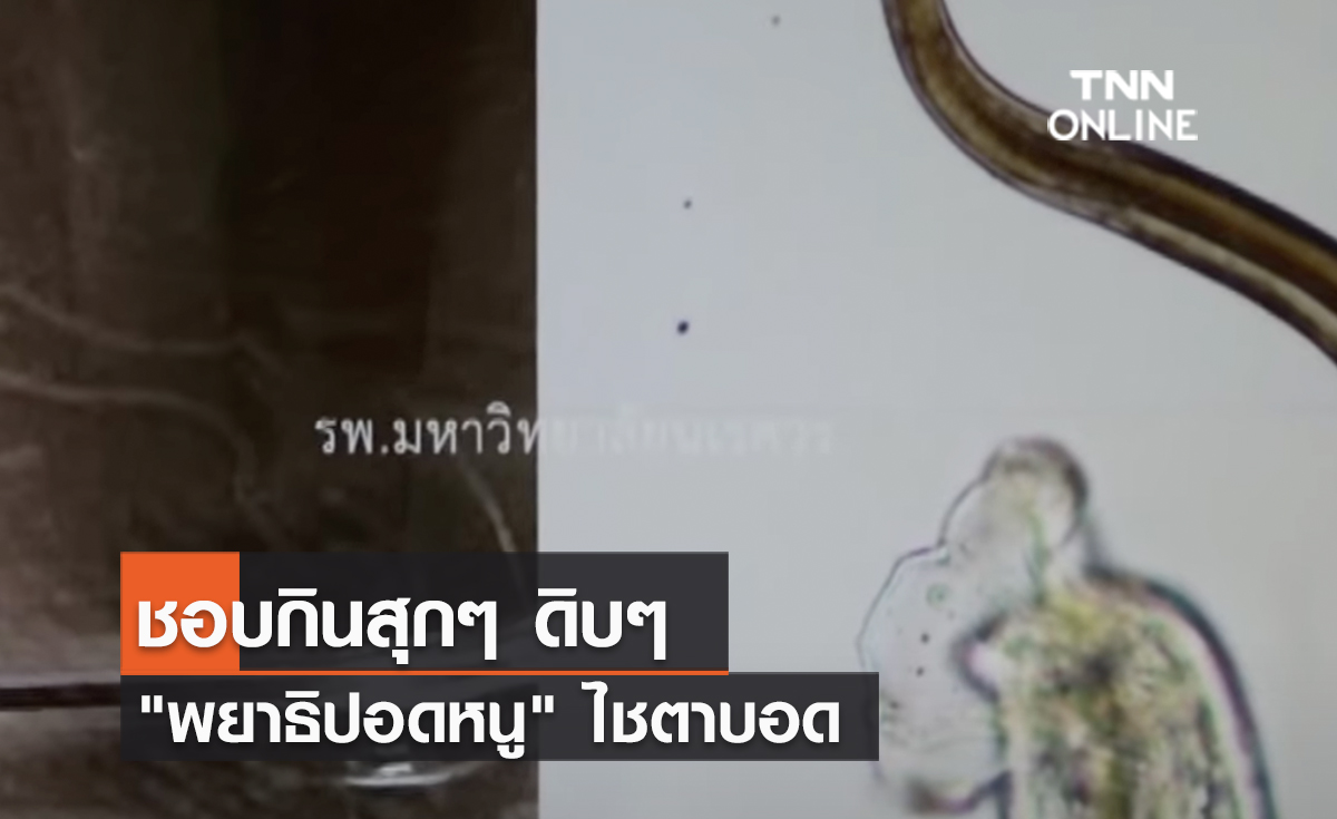 (คลิป) ชอบกินสุกๆ ดิบๆ "พยาธิปอดหนู" ไชตาบอด