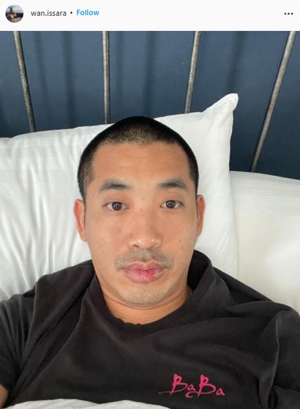 ไฮโซปลาวาฬ ซิ่งรถหรูเสียหลัก ไฟไหม้ทั้งคัน โชคดีหนีทัน