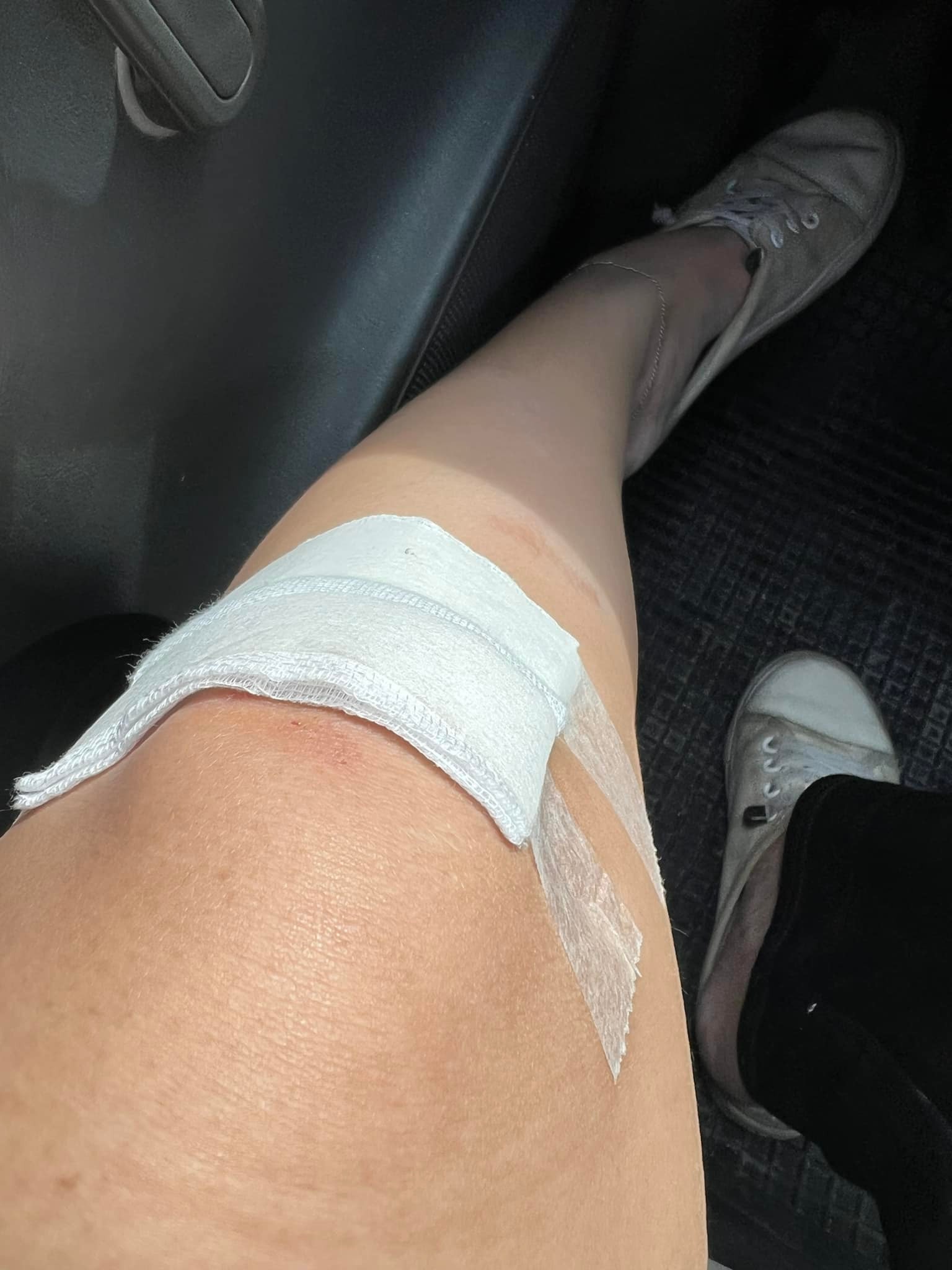 อดีตนักร้องดัง โรสแมรี่ ถูกรถชนแล้วหนี พร้อมเผยอาการบาดเจ็บ อดีตนักร้องดัง โรสแมรี่ ถูกรถชนแล้วหนี พร้อมเผยอาการบาดเจ็บ