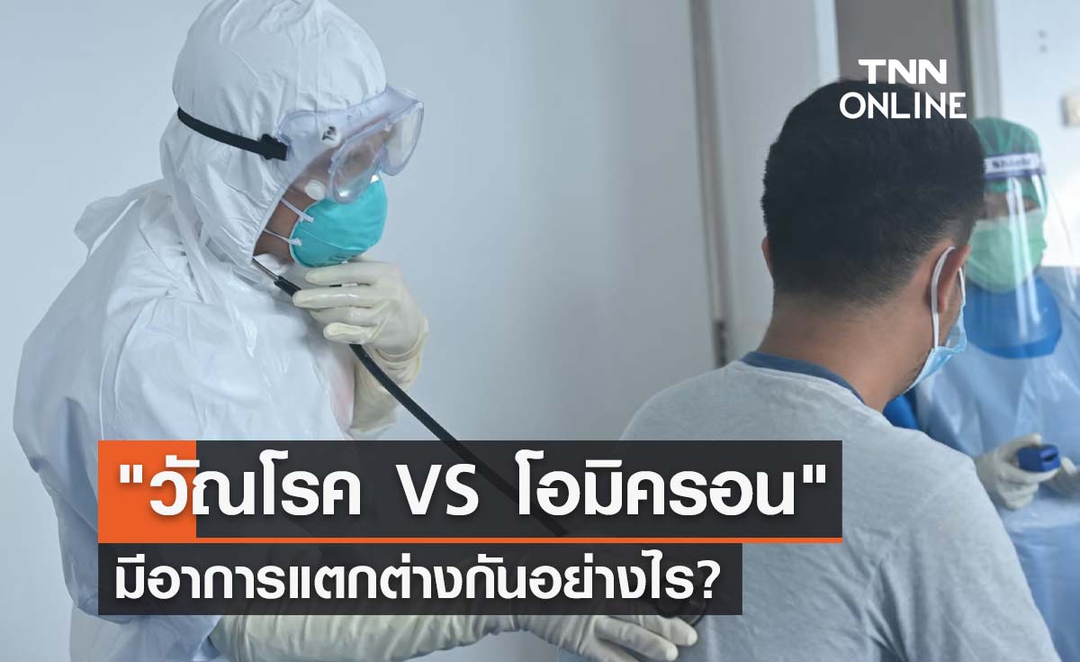 คล้ายๆแต่ไม่เหมือน "วัณโรค VS โอมิครอน" มีอาการต่างกันอย่างไร?