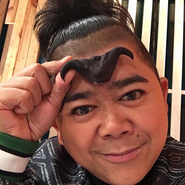 โก๊ะตี๋ อาการล่าสุด!!  รอผลเอ็กซ์เรย์ปอด