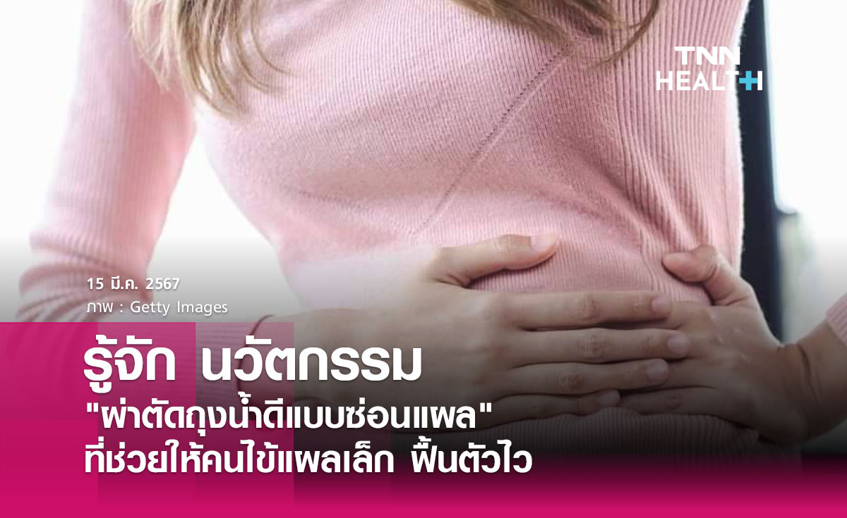 รู้จัก นวัตกรรม "ผ่าตัดถุงน้ำดีแบบซ่อนแผล" ที่ช่วยให้คนไข้แผลเล็ก ฟื้นตัวไว