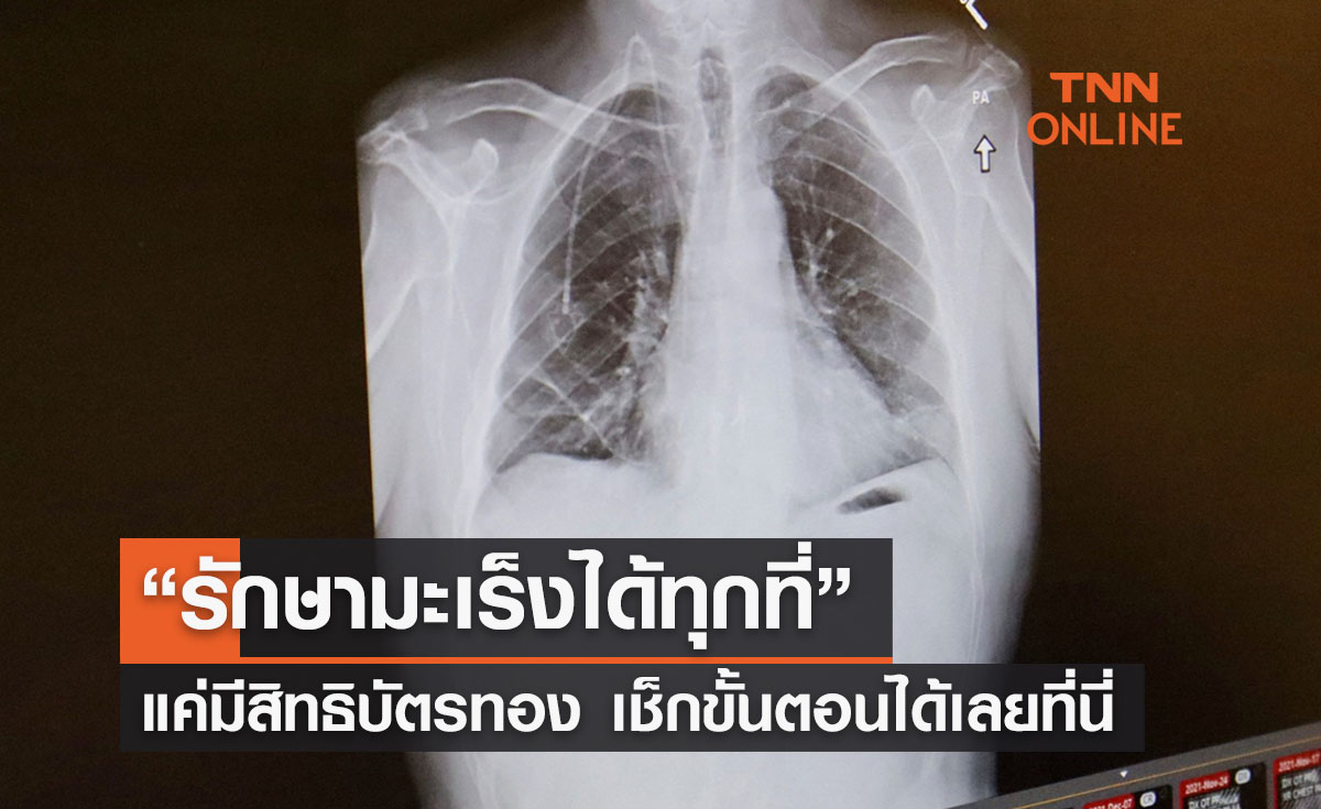 สิทธิบัตรทอง “รักษามะเร็งได้ทุกที่” เช็กขั้นตอนได้เลยที่นี่ 