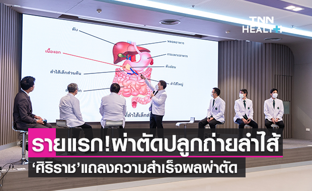 "ศิริราช"ปลูกถ่ายลำไส้และอวัยวะในช่องท้อง สำเร็จเป็นรายแรกในประเทศไทย
