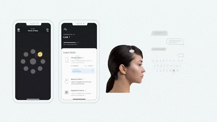 อัปเกรดสมอง วิวัฒนาการขั้นสุดยอดของมวลมนุษย์ ด้วยชิป Neuralink อัปเกรดสมอง วิวัฒนาการขั้นสุดยอดของมวลมนุษย์ ด้วยชิป Neuralink