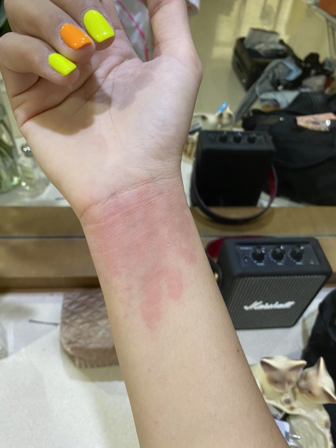 เเอ็ดมิทด่วน!! ฝ้าย สุภาพร เหตุเเพ้บาธบอมอย่างหนัก เเอ็ดมิทด่วน!! ฝ้าย สุภาพร เหตุเเพ้บาธบอมอย่างหนัก